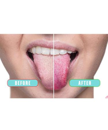 Premium Metal Tongue Cleaner & Scraper - Copper Oral Hygiene Tool for Bad Breath Relief | Eco-Friendly Etui Included - Buy Online on SooperMarket.com