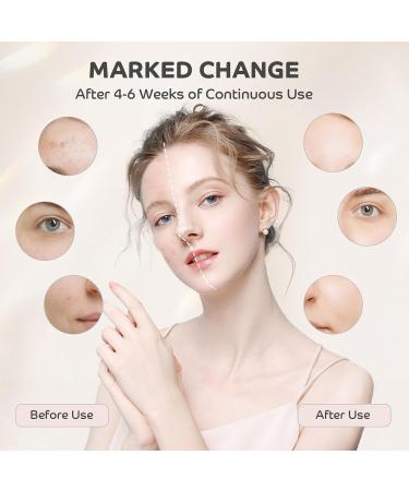 Hottoerak Red Light for Face upgrade 850nm Near-Infrared Light & 660nm Red Light Professional Red Light Lamp at Home Gray - Buy Online on SooperMarket.com