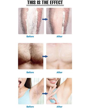 Crystal Hair Eraser for Women Legs - Painless Hair Removal Tool - Washable Nano Hair Remover - Smooth Skin Effect - Black - Buy Online on SooperMarket.com