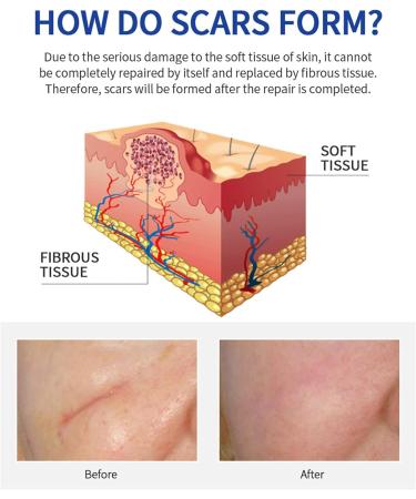 Shark Scar Repair Water 30ml - Moisturizing Scar Removal Liquid for Skin Repair | Color One Size - Buy Online on SooperMarket.com