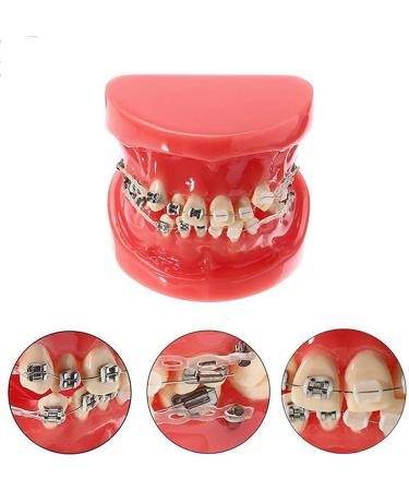 Orthodontic Braces Model Doll-10 - Ceramic Teeth Study for Adults | Ideal for Medical Science & Teaching Research - Buy Online on SooperMarket.com