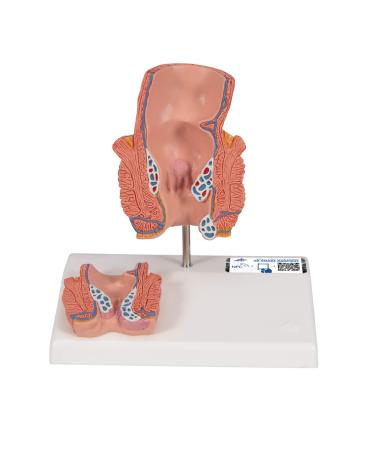 3B Scientific K27 Hemorrhoid Model 5.5-Inchx3.9-Inchx5.5-Inch