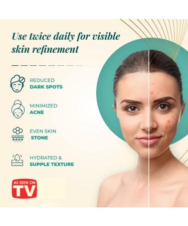 VoilaVe Hyaluronic Acid Serum | Anti-Aging & Hydrating Face Serum with Vitamin C | Reduce Dark Spots & Acne | Wrinkle-Reducing & Brightening 1 Oz - Buy Online on SooperMarket.com