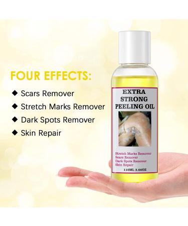 Yellow Peeling Oil for Dark Skin - Strong Extra Strength Exfoliating Solution with Salicylic Sodium Hyaluronate - 110ML/3.66 OZ - Buy Online on SooperMarket.com