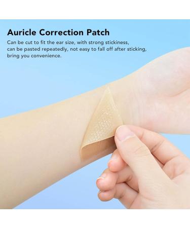 Anggrek Baby Auricle Valgus Correction Patch - Professional Silicone Infant Ear Aesthetic Corrector - Buy Online on SooperMarket.com