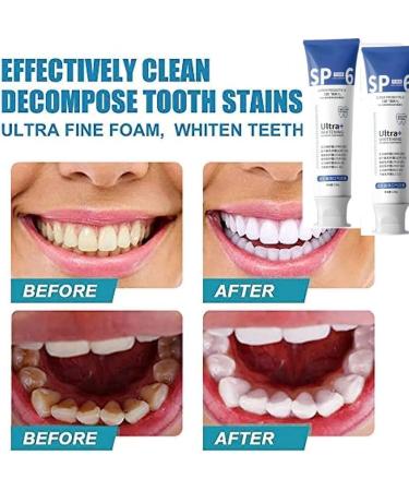 SP-6 Ultra Whitening Toothpaste - Probiotic Brightening Deep Cleaning Prevents Tartar Fresh Breath | International Shipping - Buy Online on SooperMarket.com