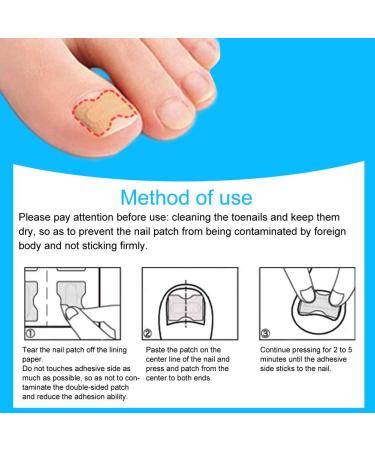 Ingrown Toenail Correction Foot Care Pedicure Sticker Corrector Ingrown Patch Relief Toe Patch Treatment Tool60pcs (60 Pieces) - Buy Online on SooperMarket.com