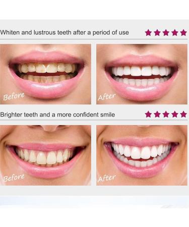 1/2Pcs CrystalClean Smile Powder MediLisk Mint Tooth Powder The New Teeth Whitening Solution Get White Teeth in 7 Days (1PCS) - Buy Online on SooperMarket.com