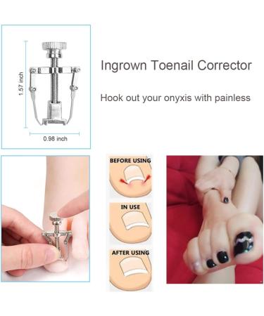 Premium 8Pcs Ingrown Toenail Tools Kit for Nail Treatment - Correction Clippers, File Lifter, Professional Pedicure Tool - Buy Online on SooperMarket.com