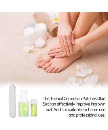 Ingrown Toenail Correction Kit Elastic Toe Nail Straightener Patch with Nail File Glue - Buy Online on SooperMarket.com