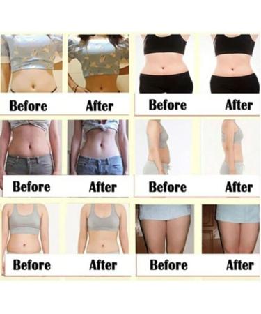 Mugwort Belly Button Patch (60PCS) - Natural Plant for Men and Women - White - Buy Online on SooperMarket.com