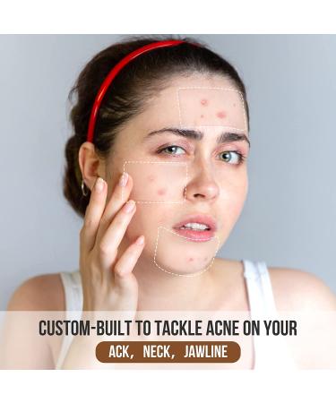 AUSLKA Large Blemish Pimple Patches (20 Strips) - Hydrocolloid Spot Dots for Blemishes - XL Ultra Thin 20 Count - Buy Online on SooperMarket.com