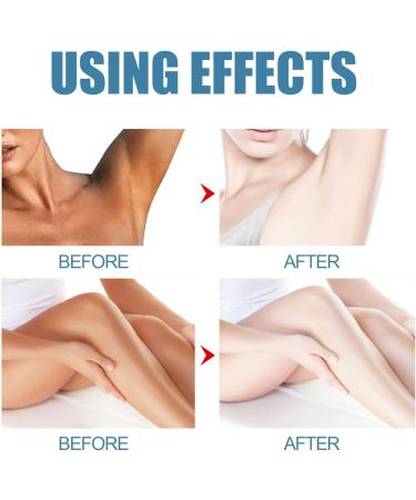 Underarm Whitening Cream Natural Armpit Whitening Cream Effective Body Skin Lightening & Brightening Cream for Knees Elbows Sensitive & Private Areas Whitens Nourishes Restores Skin - Buy Online on SooperMarket.com