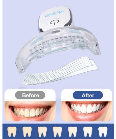 MySmile Teeth Whitening Kit - 14 Non-Sensitive Strips for Fast, Natural Whitening - Buy Online on SooperMarket.com