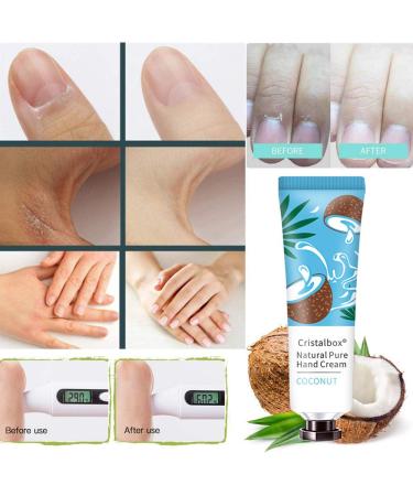 18 Pack Hand Cream Gift Set with Shea Butter - Mini Travel Size Lotion for Dry Cracked Hands - Moisturizing Lotion Gift for Women - Perfect Bulk Gift for Wife, Girlfriend, Mother - 30g - Buy Online on SooperMarket.com