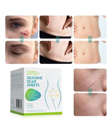 Silicone Scar Tape 4cm x 1.5m - Self Adhesive & Non-irritating - C Section & Burn Scar Removal - Meat Color - Buy Online on SooperMarket.com