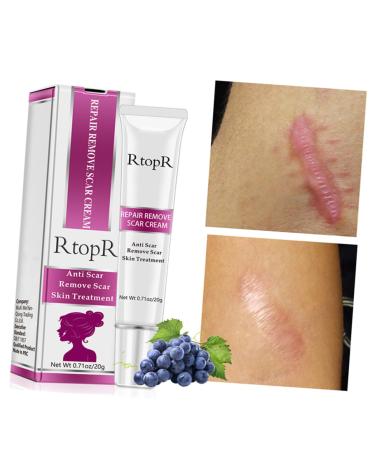 PLAFOPE Scar Cream - Scar Eraser & Remover for Face, Stretch Marks, Skin Repair - 1pc - Buy Online on SooperMarket.com