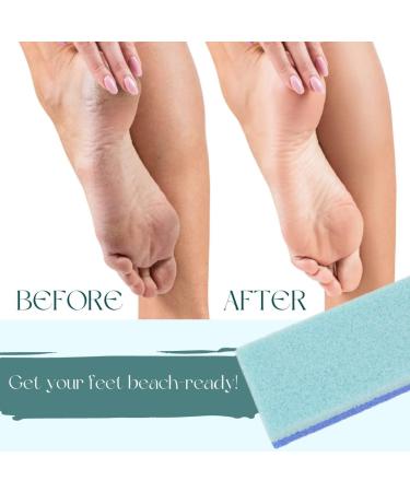 Mantello Foot Scrubber Pumice Stone 4 Pack - Double Sided Dead Skin Remover for Shower and Foot Tub - Pedicure Supplies Feet Scrubber - Buy Online on SooperMarket.com