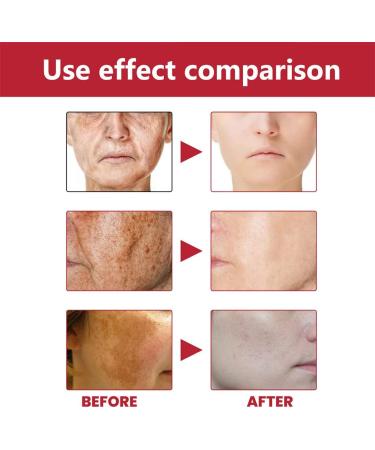 Dajidafu Women Face Whitening Brightening Girls Natural Ingredient Moisturizing Essence Female Portable Stock Solution - Buy Online on SooperMarket.com