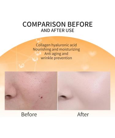 Collagen Facial Spray Collagen Face Mist Deep Hydrating & Nourishing Tightens Fine Lines & Wrinkles Moisturizer Spray Anti Aging Skin Care for Dry and Dehydrated Skin Vegan Cruelty Free - Buy Online on SooperMarket.com