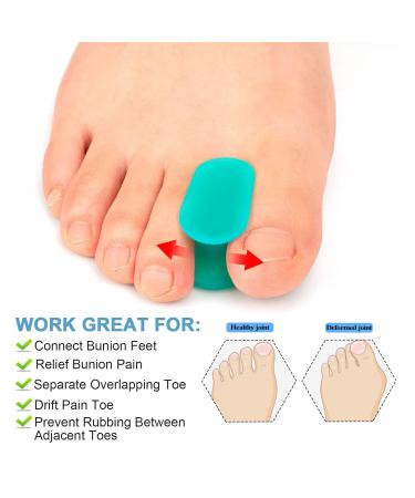 Soft Silicone Toe Separator Spacers for Bunions - Men and Women - Skin Friendly - Correct Overlapping Toes - Sports Activities - Buy Online on SooperMarket.com