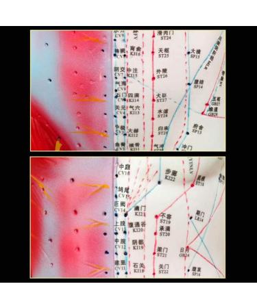 Acupuncture Template - Acupuncture and Male Muscle - 85cm - Half Skin and Half Point Point and Meridians Anatomy - Buy Online on SooperMarket.com