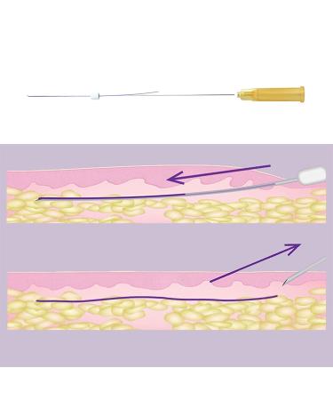 Acada PDO Thread Lift | 20Pcs 29G*38MM Mono Smooth Threads for Face & Body - Buy Online on SooperMarket.com