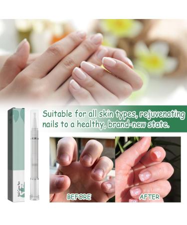 Hongecb Nail Care Pen - Strengthen & Protect Fingernails & Toenails | Easy Application | Health Routine Nail Care | 1PCs for Everyday Use - Buy Online on SooperMarket.com