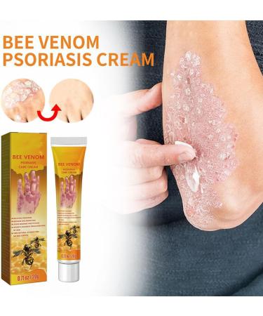 RJDJ Bee Venom Psoriasis Treatment Cream - Professional New Zealand Formula for All Skin Types (5PC) - Buy Online on SooperMarket.com