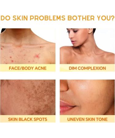 Kojic Acid Soap Kojic Soap Bar Skin Lightening Soap Bath Soap Fades Age Spots Freckles Revitalize and Moisturizing Cleansing Soap for Dark Spots Uneven Skin Tone - Buy Online on SooperMarket.com