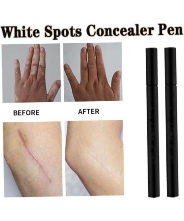 White Spots Concealer Pen Long Lasting Vitiligo Scars Birthmarks Cover Pencil Waterproof Natural Camouflage Makeup Pen - Buy Online on SooperMarket.com