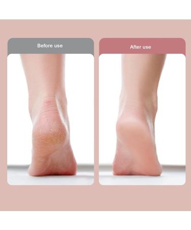 Electric Foot File USB Rechargeable Portable Waterproof Foot File Pedicure Tool for Dead Skin Removal with 2 Speeds Control Adjustable (-1411240090613) Yinhing42goxq9zs0-13 - Buy Online on SooperMarket.com