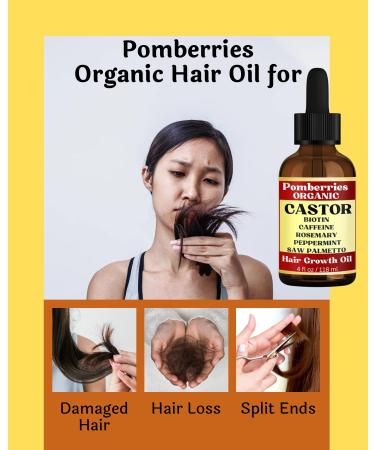 Organic Castor Oil Scalp Treatment - Rosemary Biotin & Mint for Hair Growth & Strength - 4 fl oz | Nourish & Reduce Hair Loss - Buy Online on SooperMarket.com