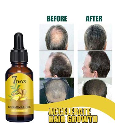 Luxsea Ginger Hair Care Nutrient Solution - Buy Online on SooperMarket.com