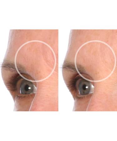 SiO Beauty BrowLift Forehead Anti-Wrinkle Patch - Rapid Overnight Reusable Silicone Patch to Reduce Furrows Expression Lines and Creases - Buy Online on SooperMarket.com