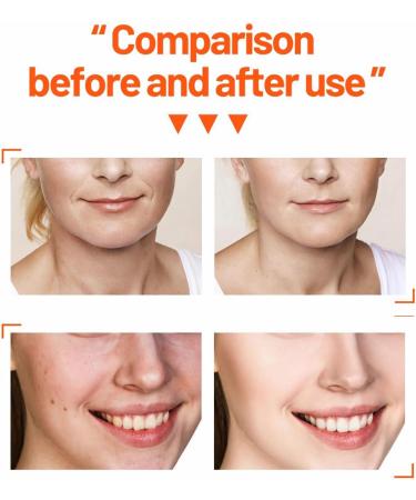 mercham Skincare Set Gifts for Teenage Girls-Vitamin C Serum for Womens Gift Sets Includes Cleanser-Toner-Serum-Face Cream Moisturizing & Brightening Facial Kit Preppy Skincare Set - All Skin Types - Buy Online on SooperMarket.com