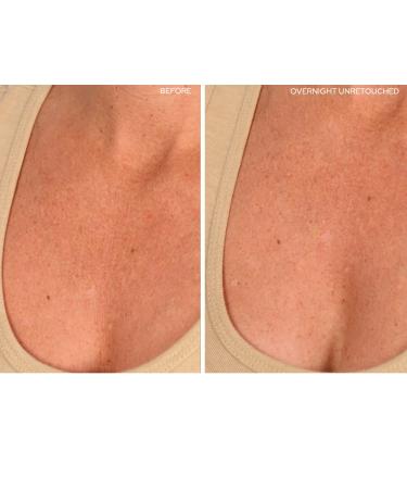 SiO Beauty Plunging Neckline - Overnight Silicone Smoothing Patches for Neck & Chest | Reusable SkinPad & Necklift - Shop Now - Buy Online on SooperMarket.com