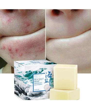 Kybbe Mite Remove Soap with Goat's Milk and Sea Salt - Eliminates Mites, Nourishes Skin - Gentle Personal Care - Buy Online on SooperMarket.com