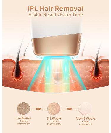IPL Hair Removal Device | 9 Energy Levels, 3 Functions | Long-Lasting Smooth Skin | 999,900 Light Pulses | White - Buy Online on SooperMarket.com