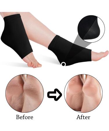 Jootuepo Gel Socks - 3 Pairs Soft Open Toe Heel Socks for Cracked Skin - Foot Care Treatment (Black) - Buy Online on SooperMarket.com
