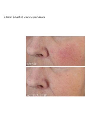 Dr Dennis Gross Vitamin C Lactic Dewy Deep Cream - Ultra-Rich Replenishing 2 oz - Buy Online on SooperMarket.com