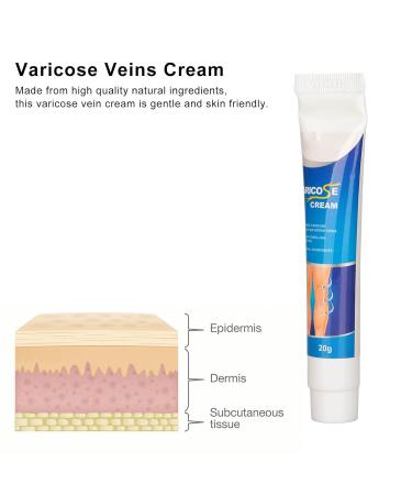 Varicose Veins Cream | Eliminate Spider Veins & Soothing Treatment - International Shipping - Buy Online on SooperMarket.com