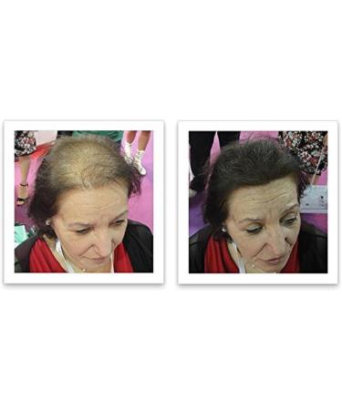Caboki Hair Loss Concealer Hair Building Fiber 25g (Black) - Buy Online on SooperMarket.com