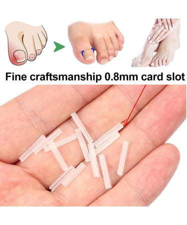 Ingrown Toenail Correction Patch Ingrown Correction Sticker 46 Pieces Ingrown Toenail Correction Patch Care Ingrown Nail Patch for Men Women - Buy Online on SooperMarket.com