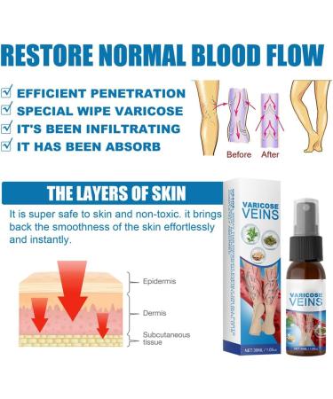 Veinhealing Varicose Veins Spray - Remove Spider Veins & Soothe Legs | 30ml Treatment for Improved Blood Circulation - Buy Online on SooperMarket.com