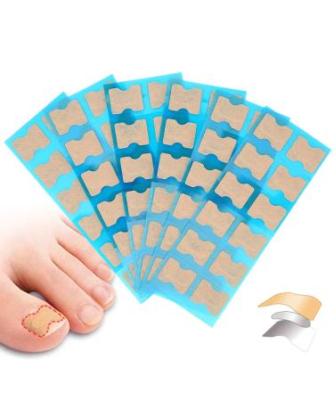 Ingrown Toenail Stick Patch Glue Free Toe Nail Correction File Patch Paronychia Corrector Foot Care Treatment Pedicure Tool Ingrown Toenail Correction Patch(3#)