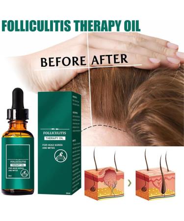BEALIFE Adults Dense Hair Essential Oil Adults Natural Ingredient Regrowth Anti-loss Moisturizing Essence Haircare - Buy Online on SooperMarket.com