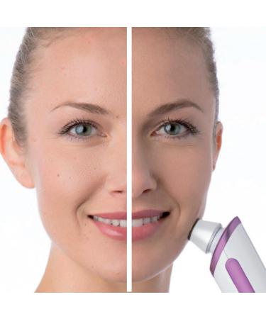 Beurer FC 76 Microdermabrasion Device - Improve Complexion & Refine Pores | Lightweight Handheld Skin Care Tool - Buy Online on SooperMarket.com
