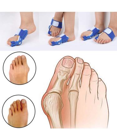 2PCS Toe Straighteners Hallux Valgus Orthotics - Big Toe Corrector for Foot Alignment - Day and Night Guard for Bone Correction - Buy Online on SooperMarket.com