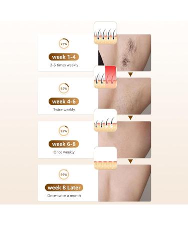 Rodzon IPL Laser Hair Removal Device - Painless Hair Remover for Women | Facial Armpits Legs Arms Bikini Line (Purple & White - Buy Online on SooperMarket.com